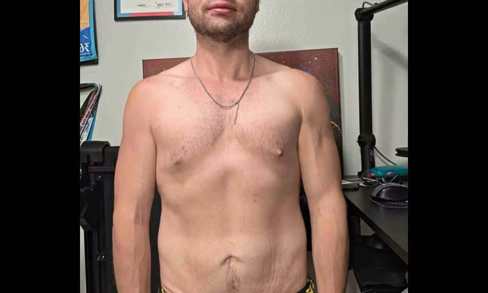 After Transformation 1