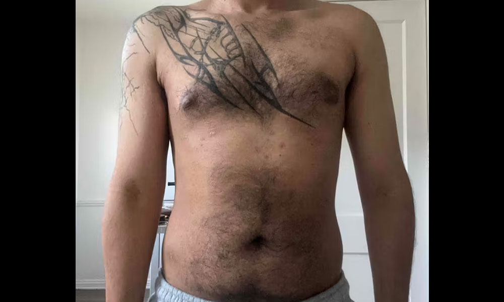 After Transformation 4
