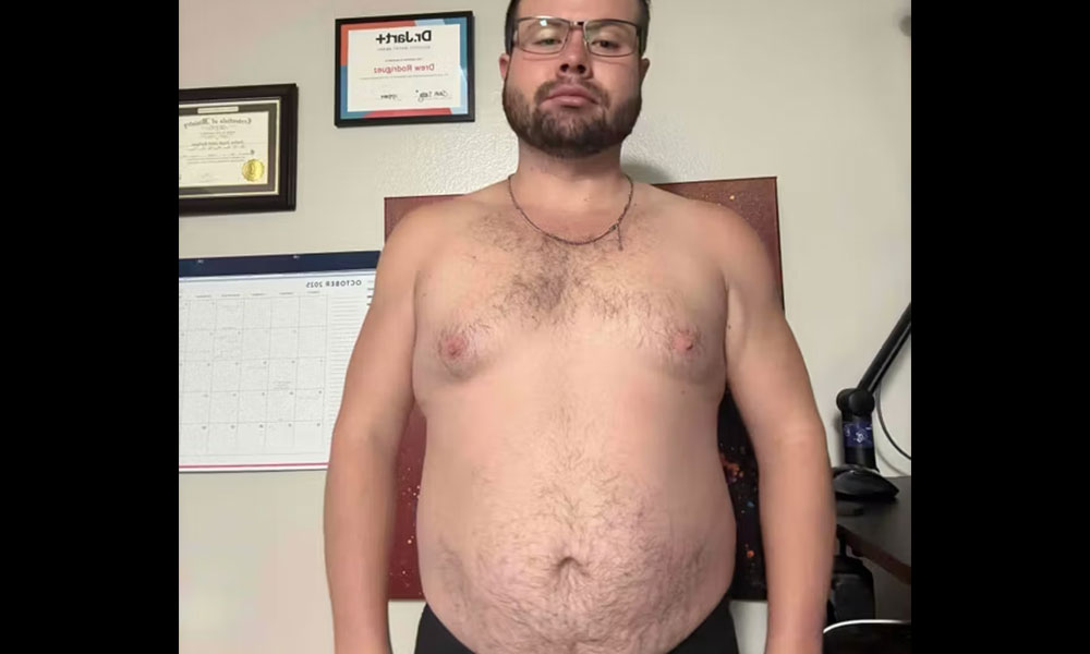 Before Transformation 1