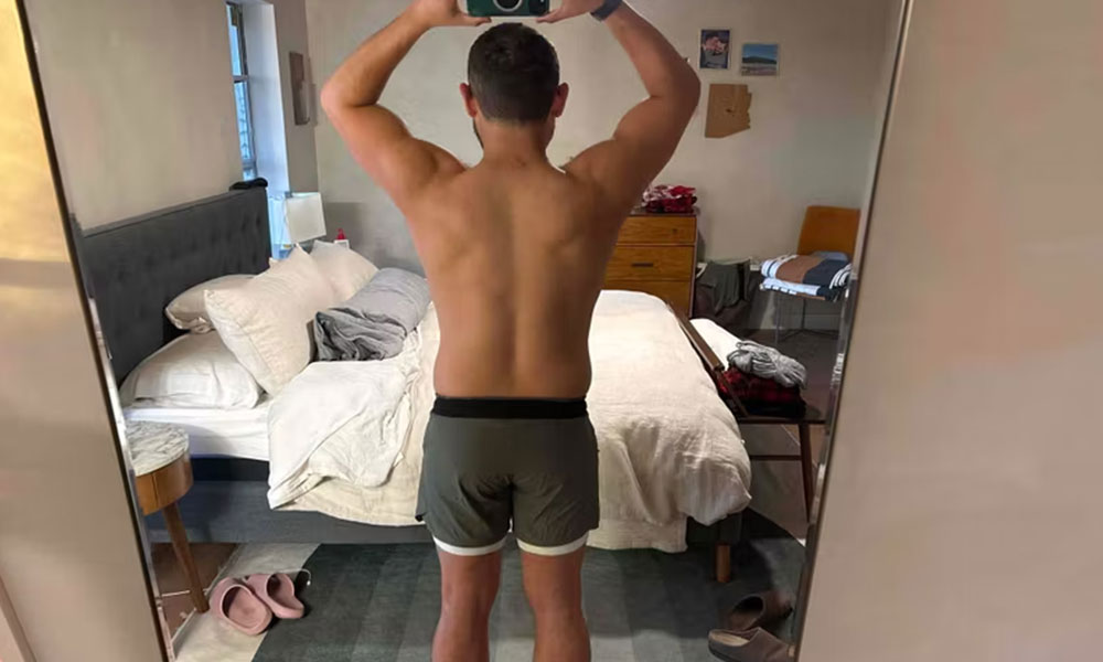 Before Transformation 2