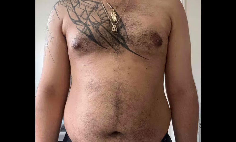 Before Transformation 4