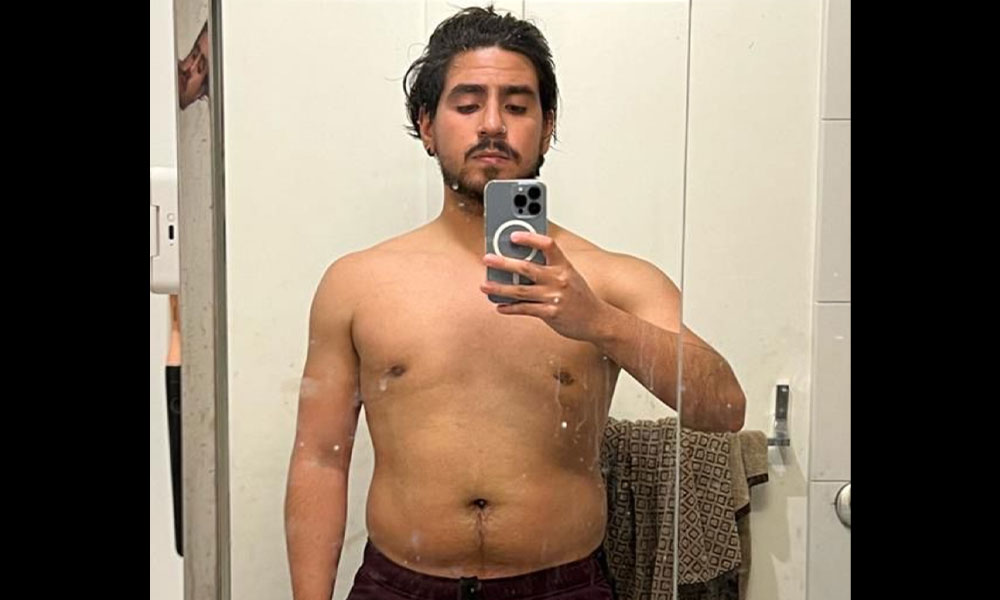 Before Transformation 5
